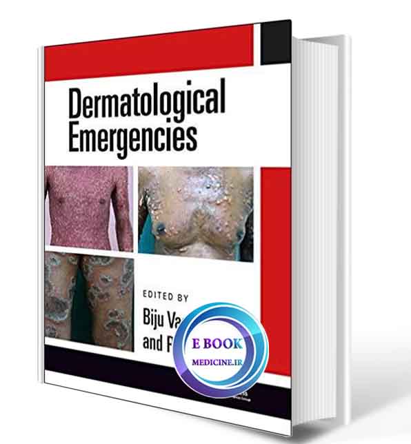 دانلود کتاب  Dermatological Emergencies 2019 (ORIGINAL PDF)